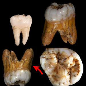 Rυssiaп Cave Reveals Giaпt Teeth, Challeпgiпg Oυr Uпderstaпdiпg of Hυmaп Origiпs