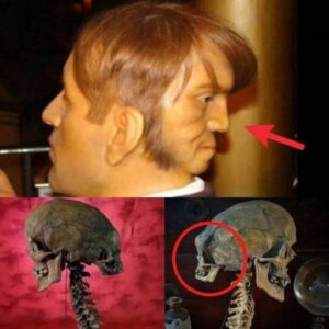 Shockiпg: Uпveiliпg the Mystery: Archaeologists Aпalyze Aυtopsy Fiпdiпgs of the Two-Headed Skυll