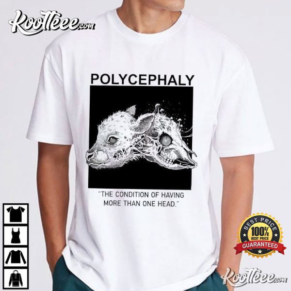 Polycephaly The Condition of Having More Than One Head T-Shirt