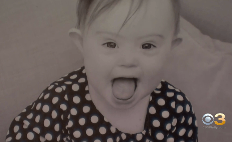 Down syndrome