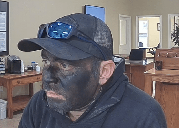 Black Face Bandit