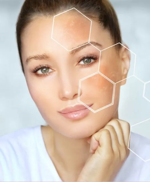 FACIAL DESPIGMENTANTE | beauty-gift