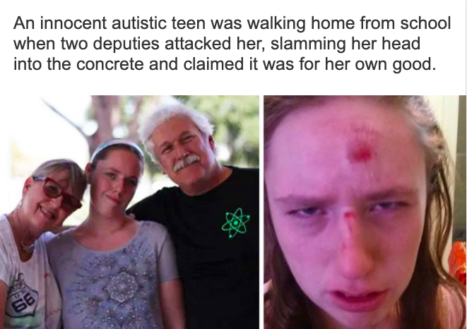 Cops Claim They Had to Smash Innocent Autistic Teen’s Head Into Concrete to “Protect Her”