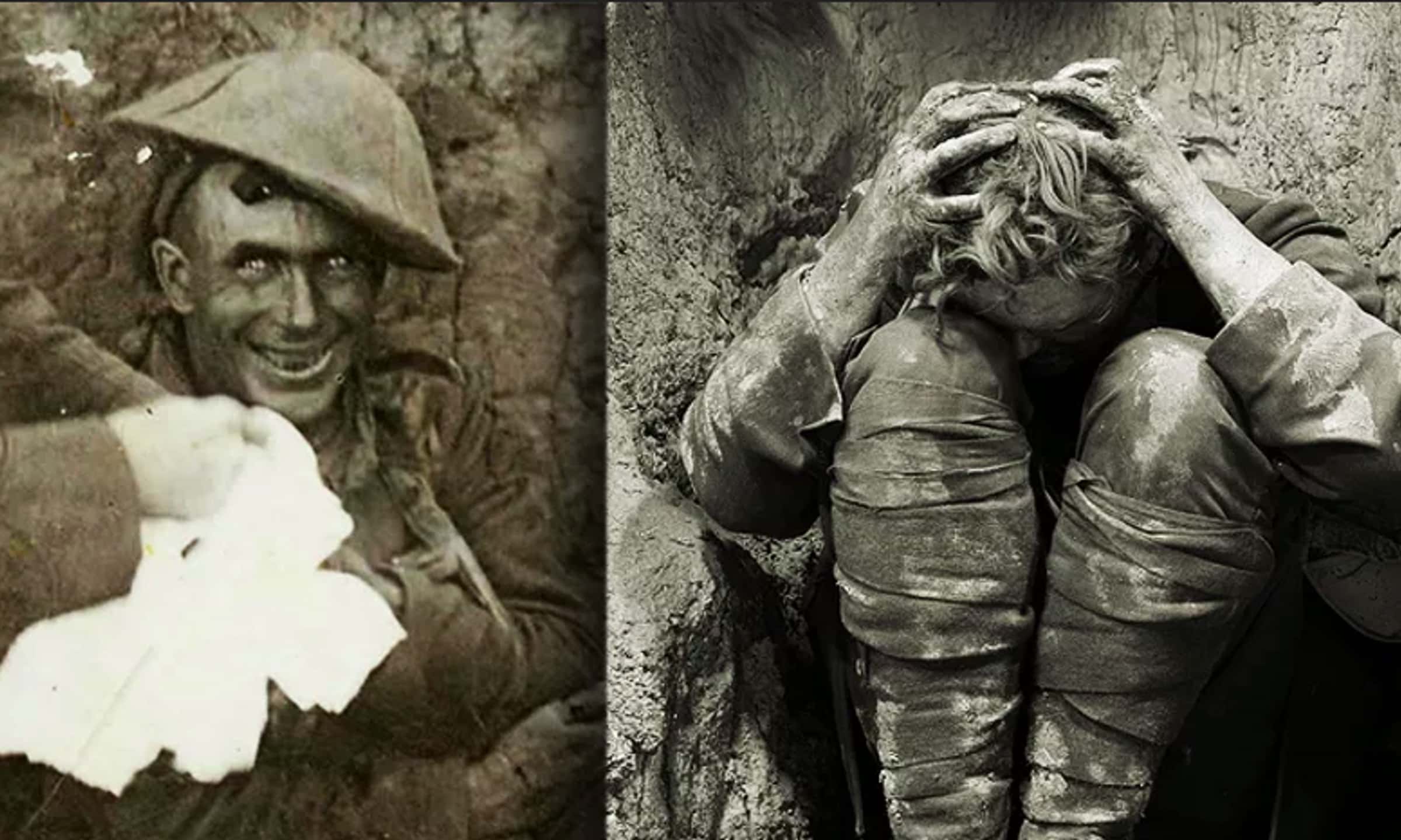 photos of soldiers with shell shock