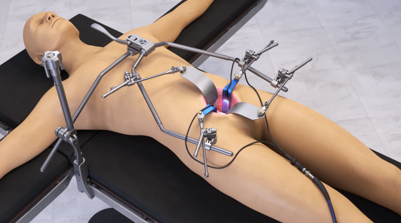 Anterior Lumbar: OneFrame Retractor Set