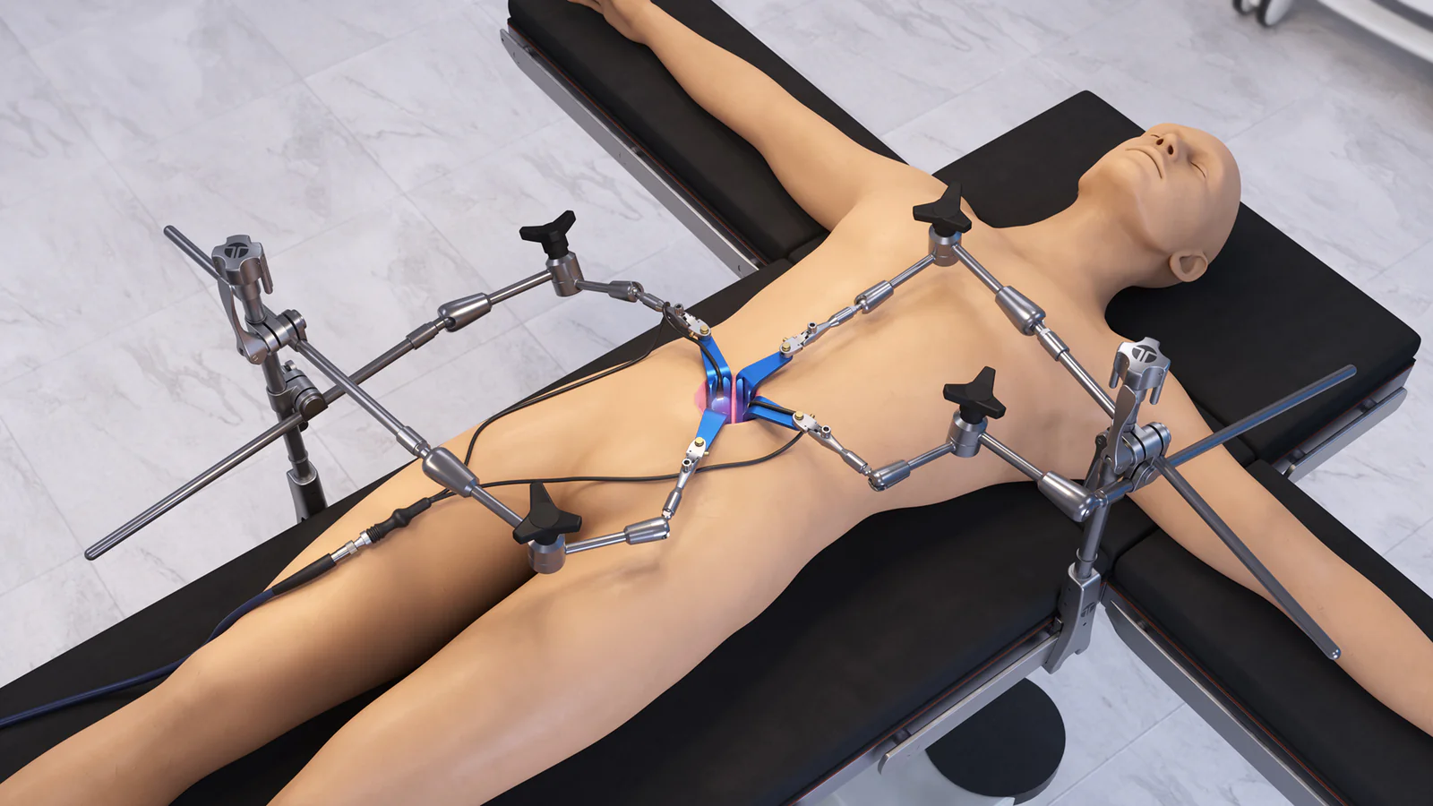 Anterior Lumbar: Articulating Arm Retractor Set