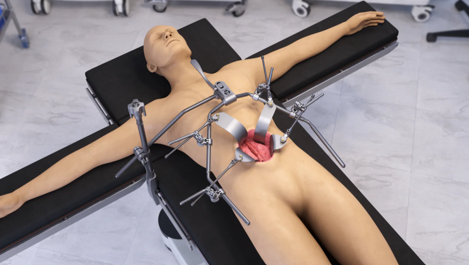 AAA OneFrame Retractor Set