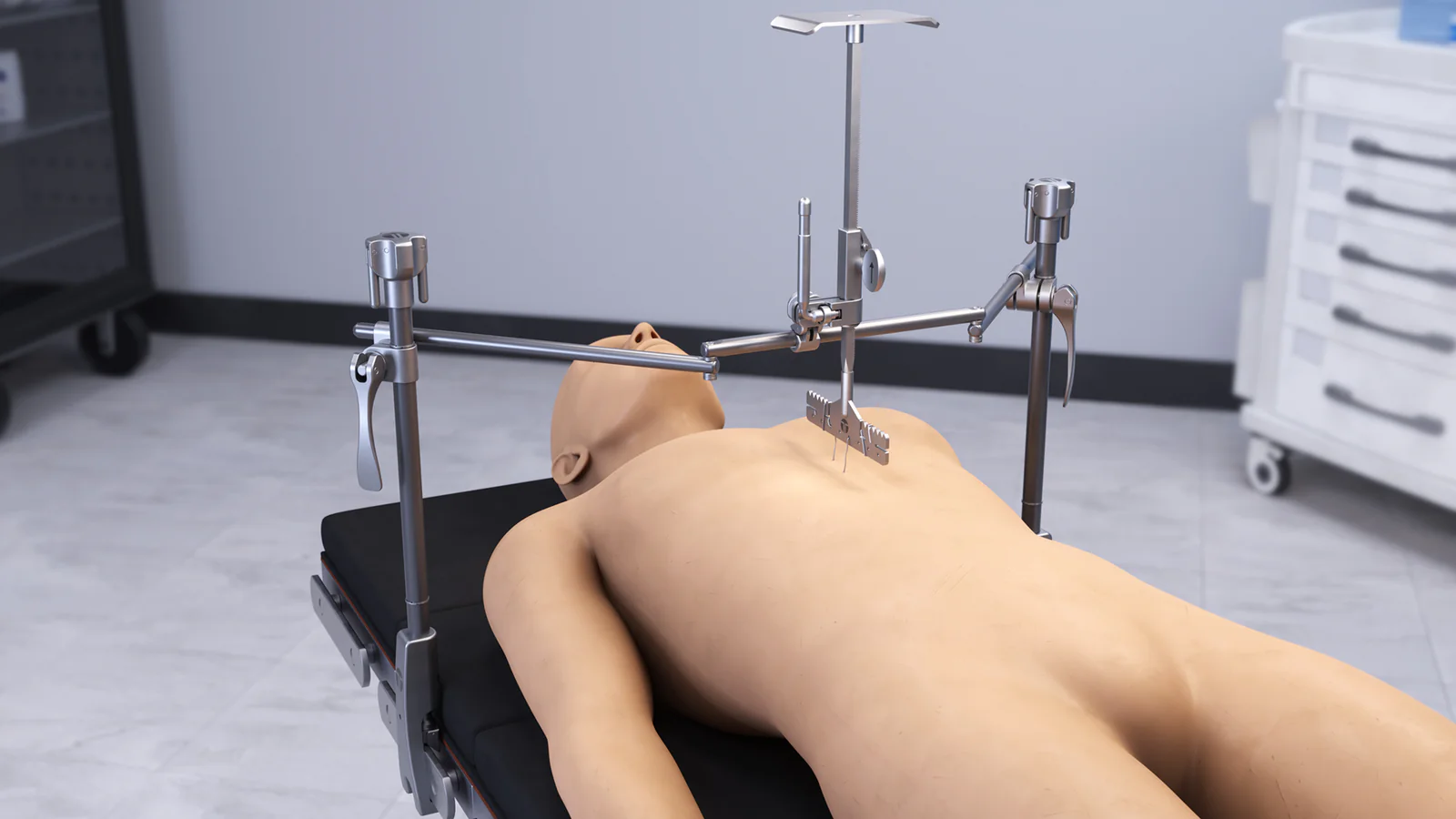 PectusAssist Retractor Set