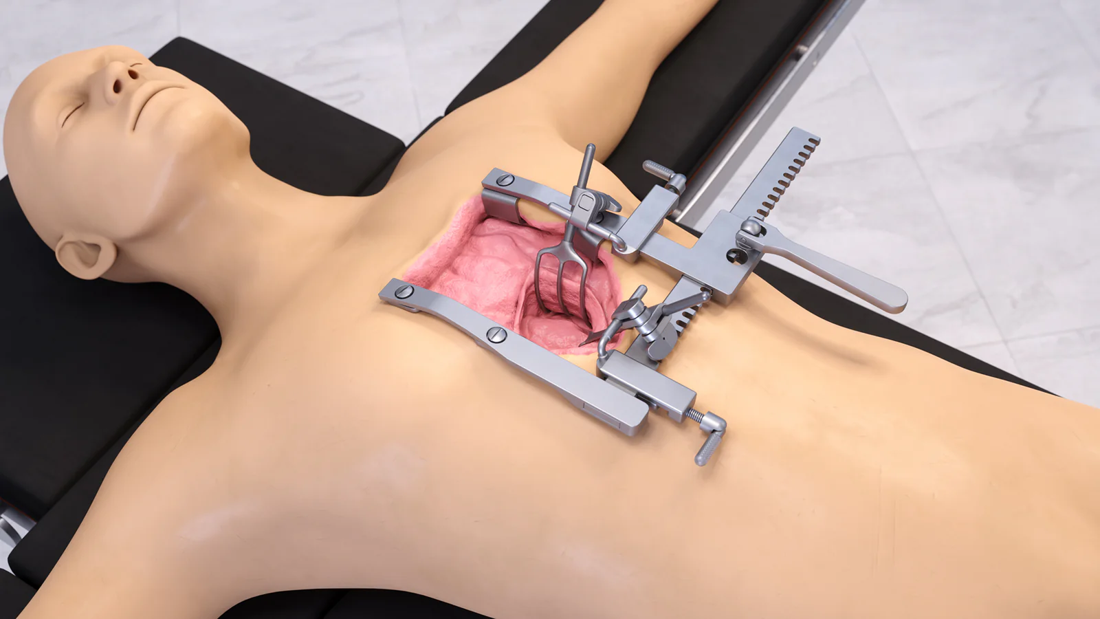 Bolling Mitral Valve Retractor Set