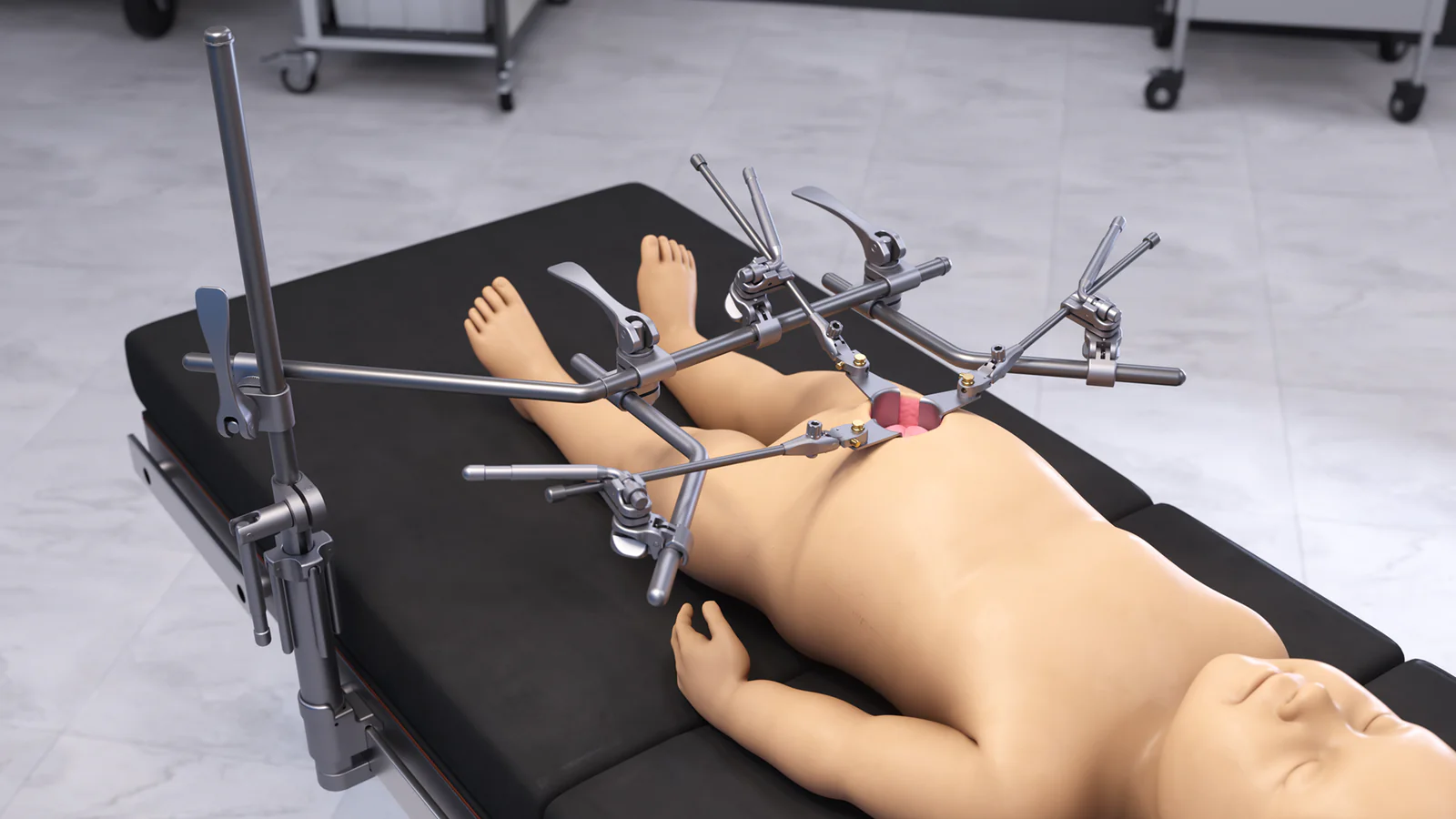 Pediatric Abdominal QuickFrame Retractor Set