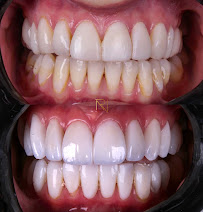 Dra Luana Pinheiro - Endodontia e Odontologia Estética