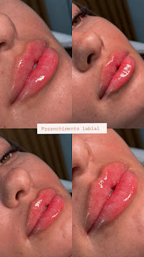 Face Clinic Odontologia e Estética | Harmonização Facial em Nova Iguaçu