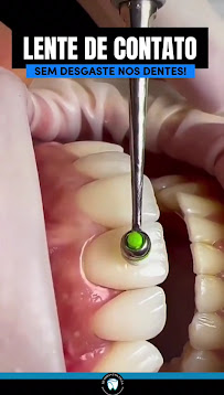 Clinic Kaah | Especialista em Estética Regenerativa e Clareamento Dental.