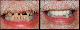 Parisien Denture Clinic Windsor (Full, Partial, Implants, Repairs, Relines, and Whitening)