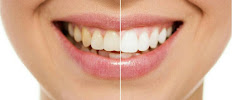 Clinica Dental Studio Dental Alcaraz