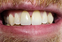 Corvallis Dental Care