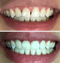 Laurelwood Dental