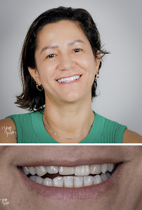 Orto Facial - Dra. Eliane Matos