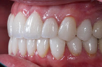 Pinnacle Dental Group - Plainfield, IL (Implant, Cosmetic, and General Dentistry)