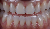 ThoroughDent Smiles
