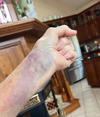 Owensboro Health Urgent Care in Powderly