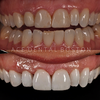 Ace Dental Boston