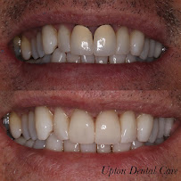 Upton Dental Care