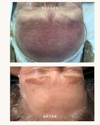 Sen Shine Laser Spa