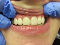 Brunswick Dental Associate-Dentista Hispana New Brunswick