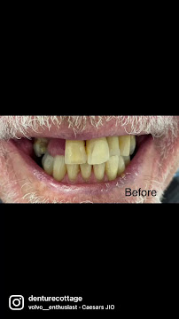 Denture Cottage