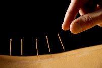HealthWorks Acupuncture, Physiotherapy & Massage Therapy Clinic
