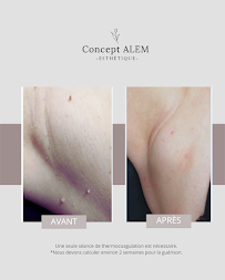 Concept Alem