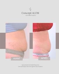 Concept Alem