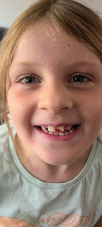 Blueridge Dental