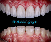 Dentist@FalseCreek, Vancouver Dentist, False creek Olympic Village Dentist & implant center