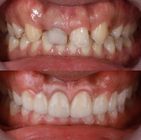 Burnaby Square Dental