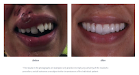 Enlighten Dental