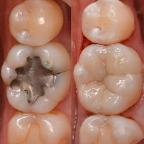 Implantes Dentales Ranalli