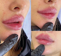 Dr. Amira Elkholy - Skin Aesthetic Clinic