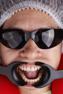 Smile design in Colombia