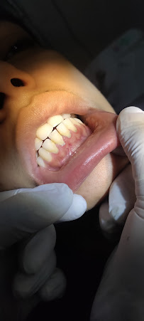 Meraki Dental Studio - Best Dentist in Delhi India
