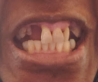 1st Family Dental-Little Village