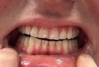 Aspen Dental - Allentown, PA - Airport Road