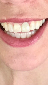 Life Bloom Dental