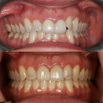 Metro City Dentistry - Cottrelle Dental Clinic