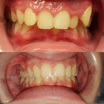 Smiles On Queen | Dentist Bolton