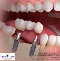 Silicon Valley Dental Center