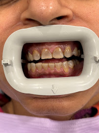Smile Lounge of Edmond