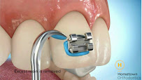 Hometown Orthodontics