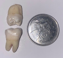 Grover Dental Care - Hayden
